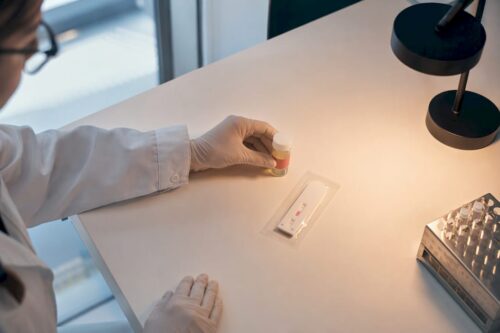 Anonyme Laborprobe neben Drogenteststreifen